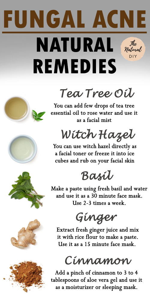 FUNGAL ACNE REMEDIES- Clean & Clear Skin - The Natural DIY